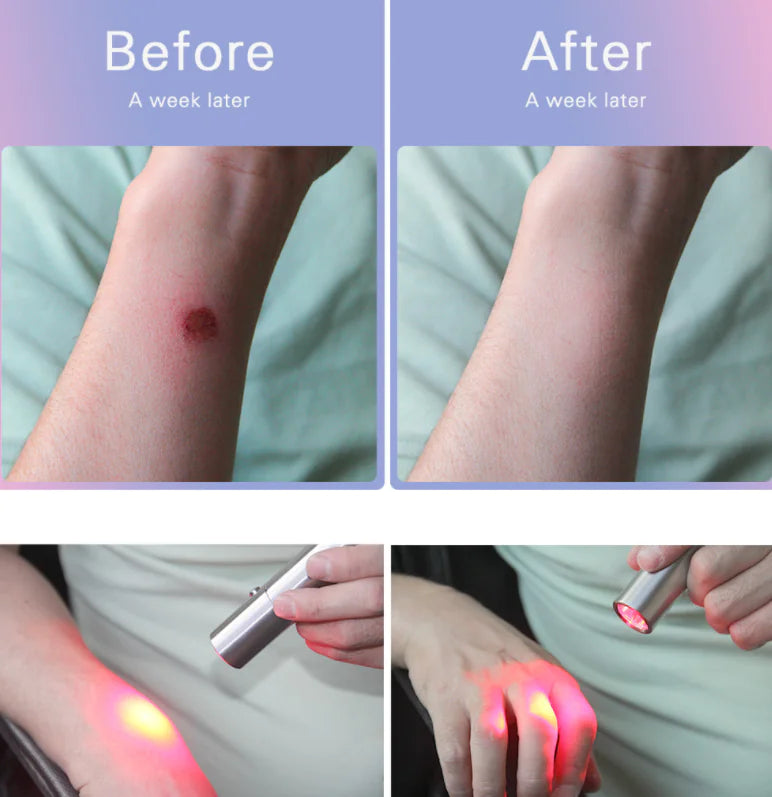 Portable Infrared Red Light Therapy Wand